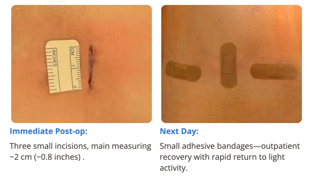 Superpath Small Incision Surgeon in focus Q&A with Dr Farah Musharbash - Spinal Surgery News